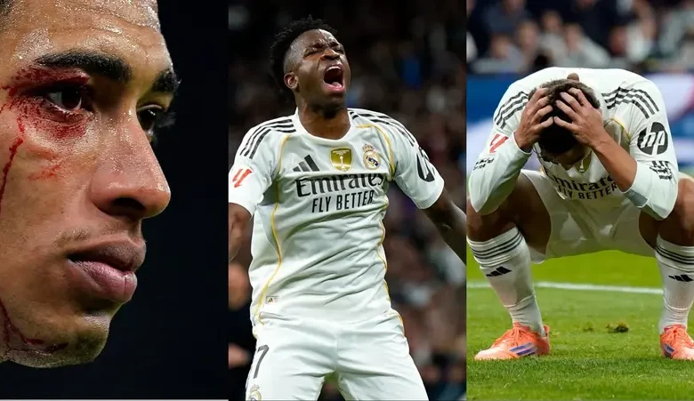 غضب هستيري في غرفة ملابس ريال مدريد بعد خسارة سلتا فيغو