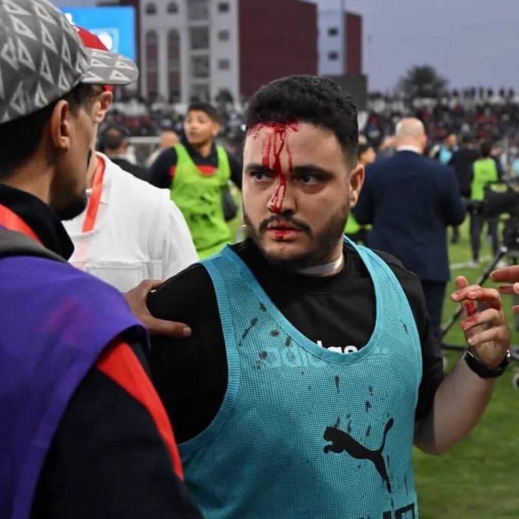 بالصور - اشتباكات دامية تؤجل نصف نهائي الكونفدرالية 80 دقيقة بين آسفي واتحاد العاصمة